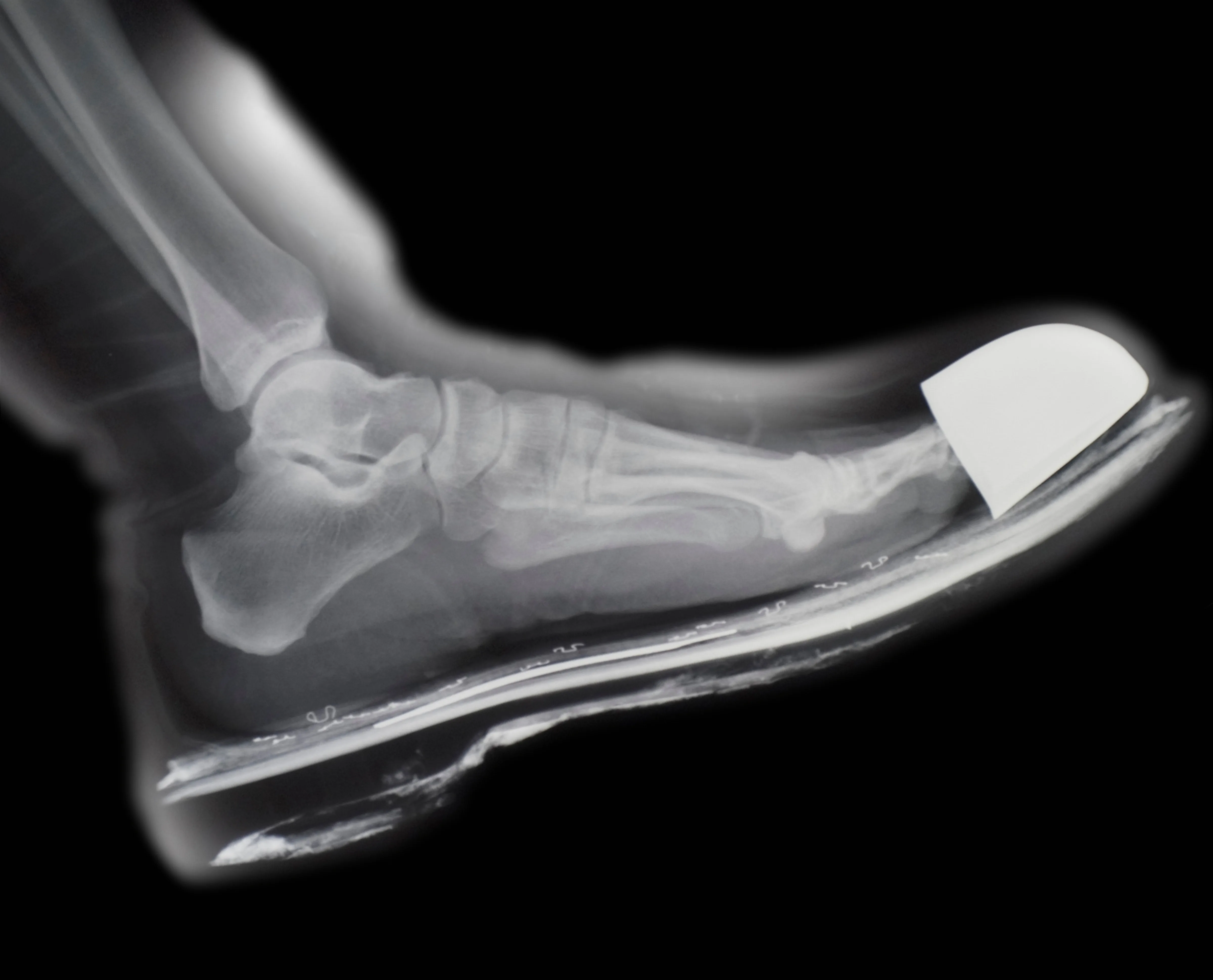 Internal Investigation of the Medical Images