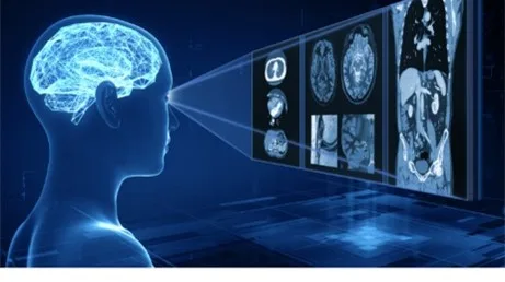AI Based Solutions for Radiology