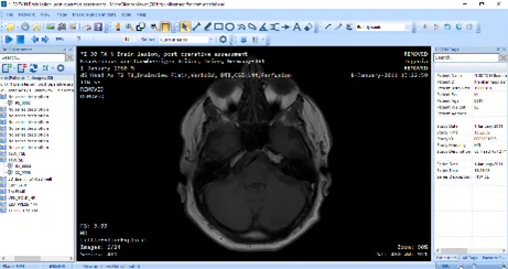 Understanding Medical Imaging 