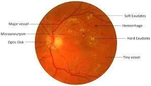 Full Scale Medical Image Analysis  